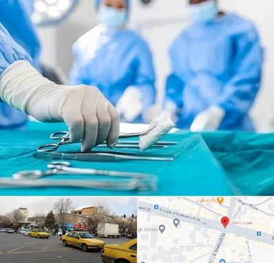 مونس پلاستی در شهناز تبریز