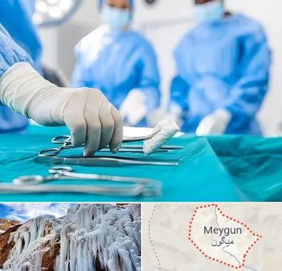 مونس پلاستی در میگون