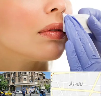 اپیلاسیون صورت در لاله زار