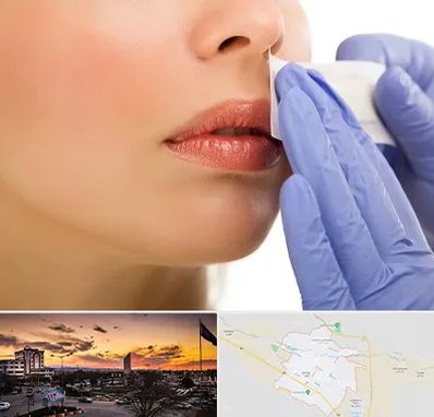 اپیلاسیون صورت در قوچان