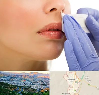 اپیلاسیون صورت در سنندج