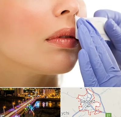 اپیلاسیون صورت در سقز