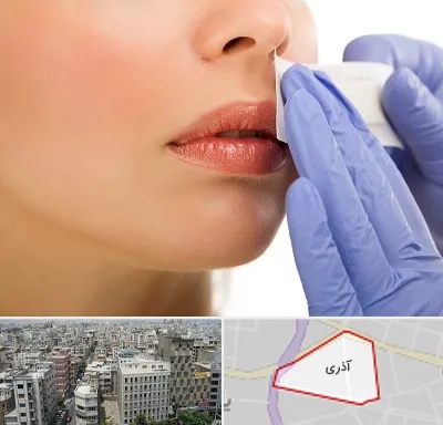 اپیلاسیون صورت در آذری