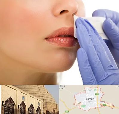 اپیلاسیون صورت در ساوه