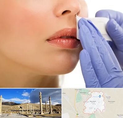 اپیلاسیون صورت در مرودشت