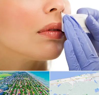 اپیلاسیون صورت در فریدونکنار