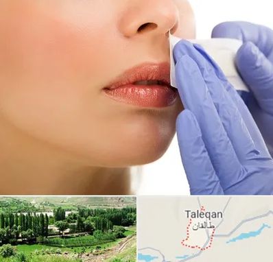 اپیلاسیون صورت در طالقان