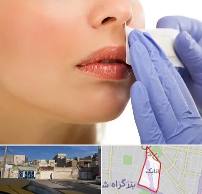 اپیلاسیون صورت در اتابک