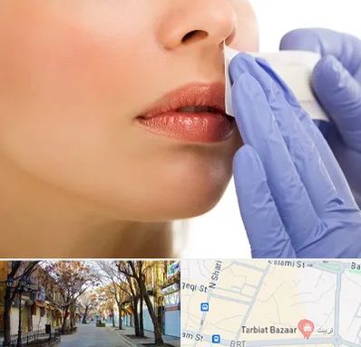 اپیلاسیون صورت در تربیت تبریز