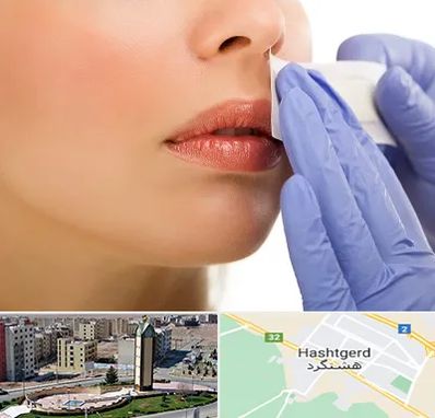 اپیلاسیون صورت در هشتگرد