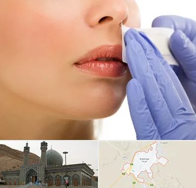 اپیلاسیون صورت در شهرضا