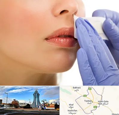 اپیلاسیون صورت در تایباد