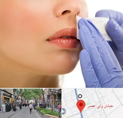 اپیلاسیون صورت در ولیعصر شهریار