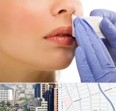 اپیلاسیون صورت در خیابان بهشتی