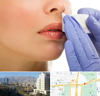 اپیلاسیون صورت در حقانی 