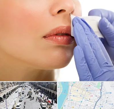 اپیلاسیون صورت در نادری اهواز