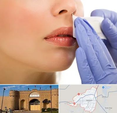 اپیلاسیون صورت در ایرانشهر