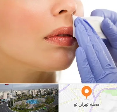 اپیلاسیون صورت در تهران نو