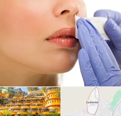 اپیلاسیون صورت در دربند