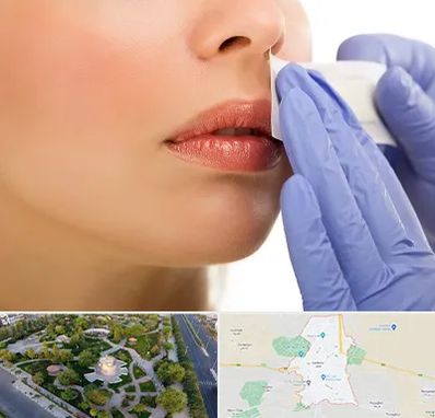 اپیلاسیون صورت در کاشمر