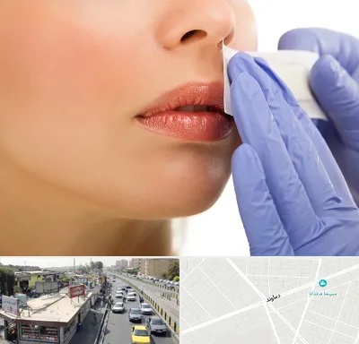 اپیلاسیون صورت در خیابان دماوند