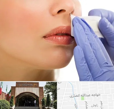اپیلاسیون صورت در خواجه عبدالله