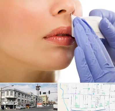 اپیلاسیون صورت در 17شهریور