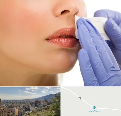 اپیلاسیون صورت در بوکان تهران