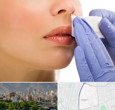 اپیلاسیون صورت در جمشیدیه