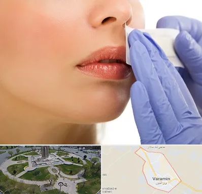 اپیلاسیون صورت در ورامین