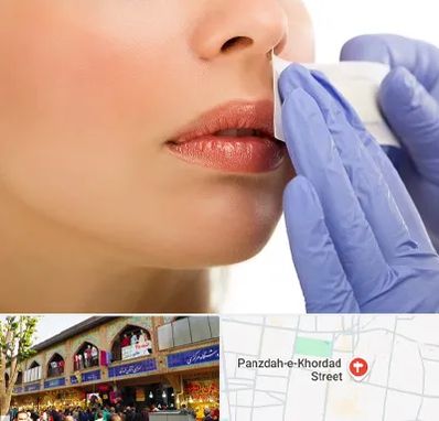 اپیلاسیون صورت در 15 خرداد