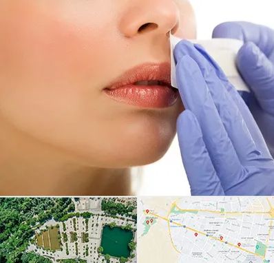 اپیلاسیون صورت در وکیل آباد مشهد