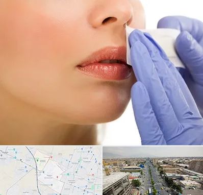 اپیلاسیون صورت در حصارک کرج