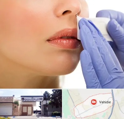 اپیلاسیون صورت در وحیدیه شهریار