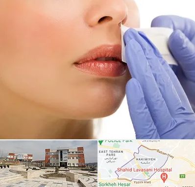 اپیلاسیون صورت در حکیمیه 