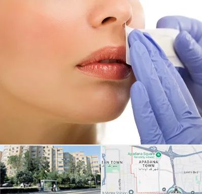 اپیلاسیون صورت در آپادانا