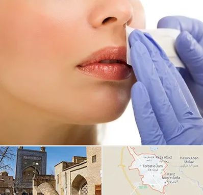 اپیلاسیون صورت در تربت جام