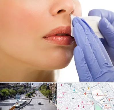 اپیلاسیون صورت در خیابان زند شیراز