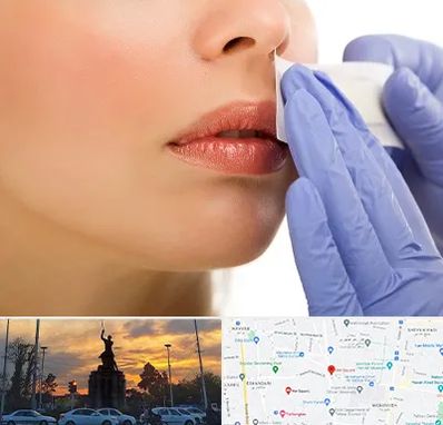 اپیلاسیون صورت در میدان حر 