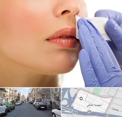 اپیلاسیون صورت در مجیدیه شمالی