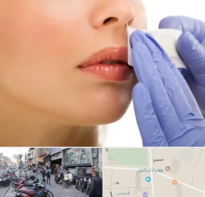 اپیلاسیون صورت در چهارراه استانبول