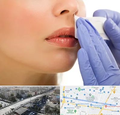 اپیلاسیون صورت در فرجام