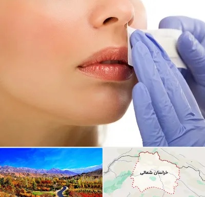 اپیلاسیون صورت در خراسان شمالی