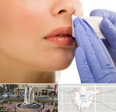 اپیلاسیون صورت در زابل