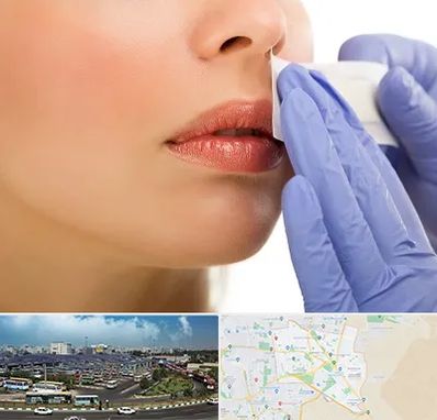 اپیلاسیون صورت در منطقه 15 تهران 