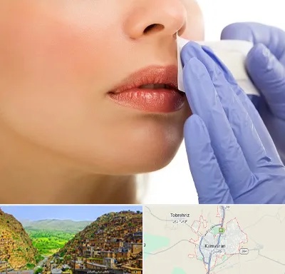 اپیلاسیون صورت در کامیاران