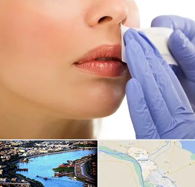 اپیلاسیون صورت در خرمشهر