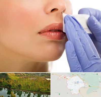 اپیلاسیون صورت در بهبهان