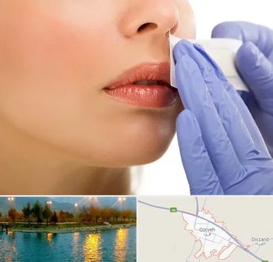 اپیلاسیون صورت در قروه