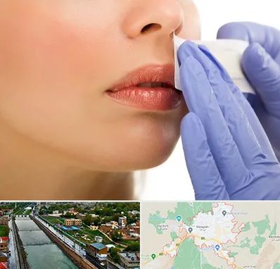 اپیلاسیون صورت در مراغه